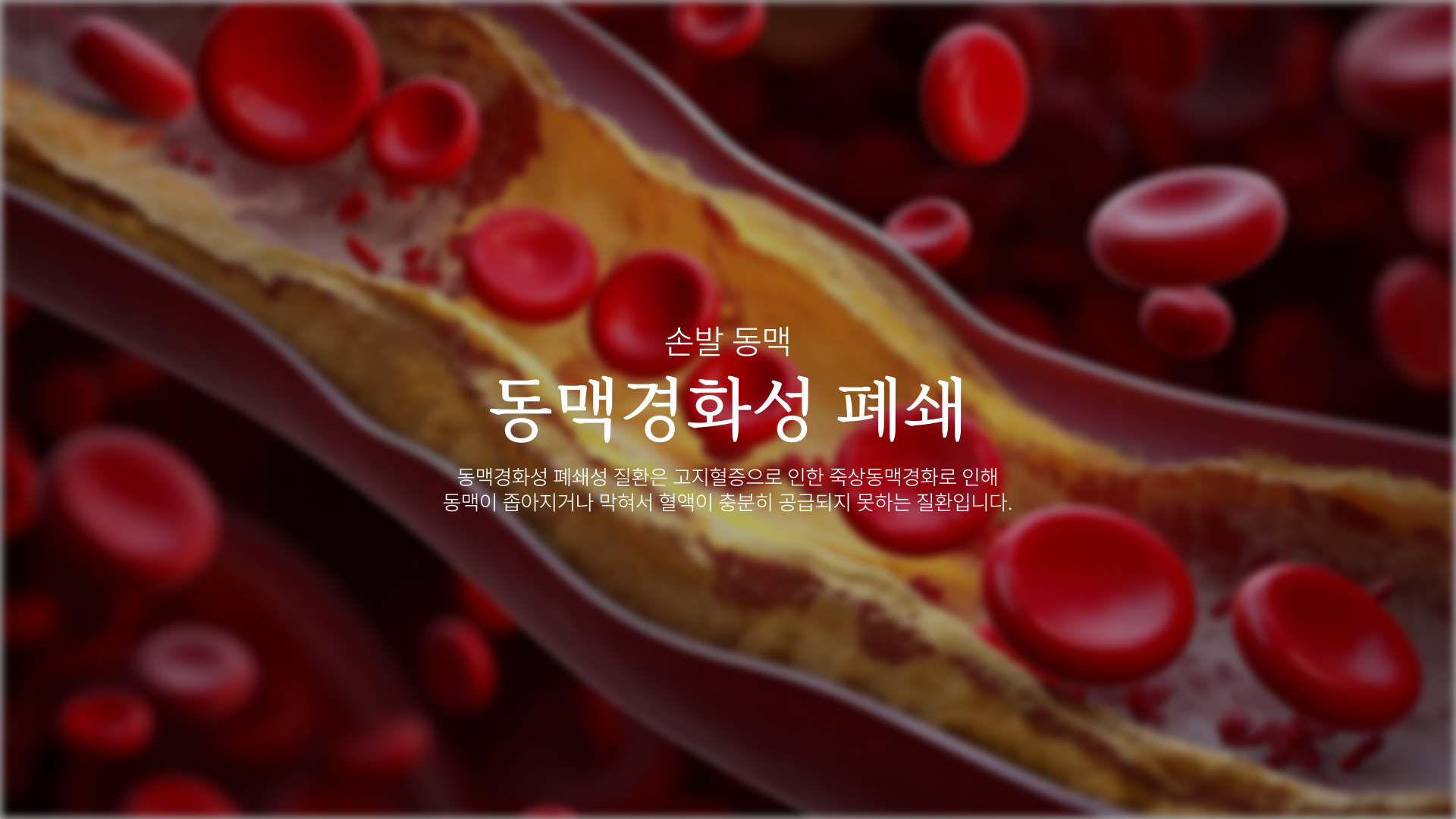 ���ư�ȭ�� �м�