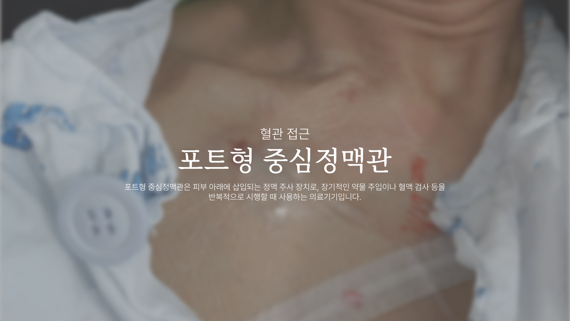 ��Ʈ�� �߽����ư�