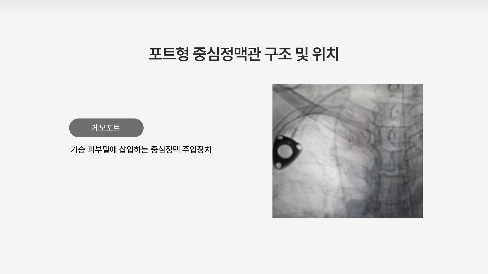 ��Ʈ�� �߽����ư�