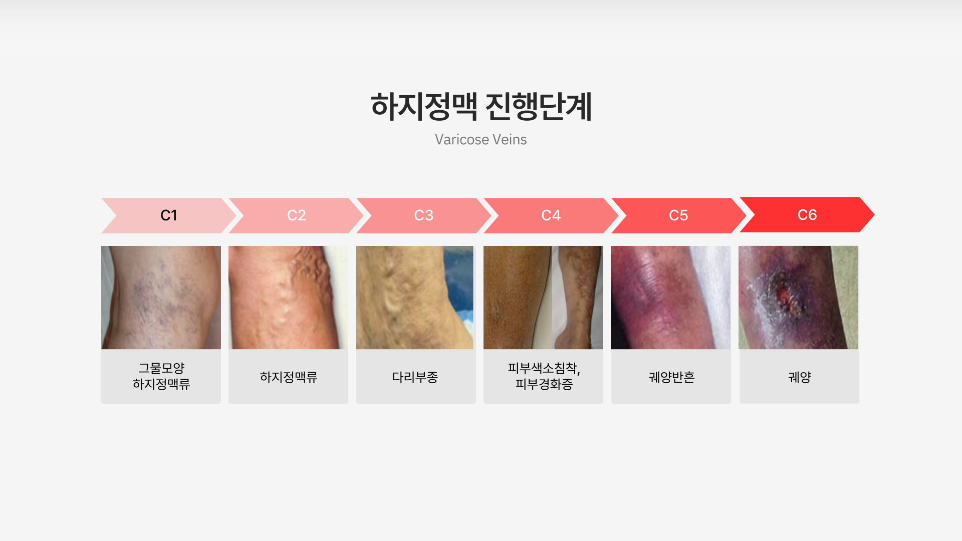 ���� ���Ʒ�